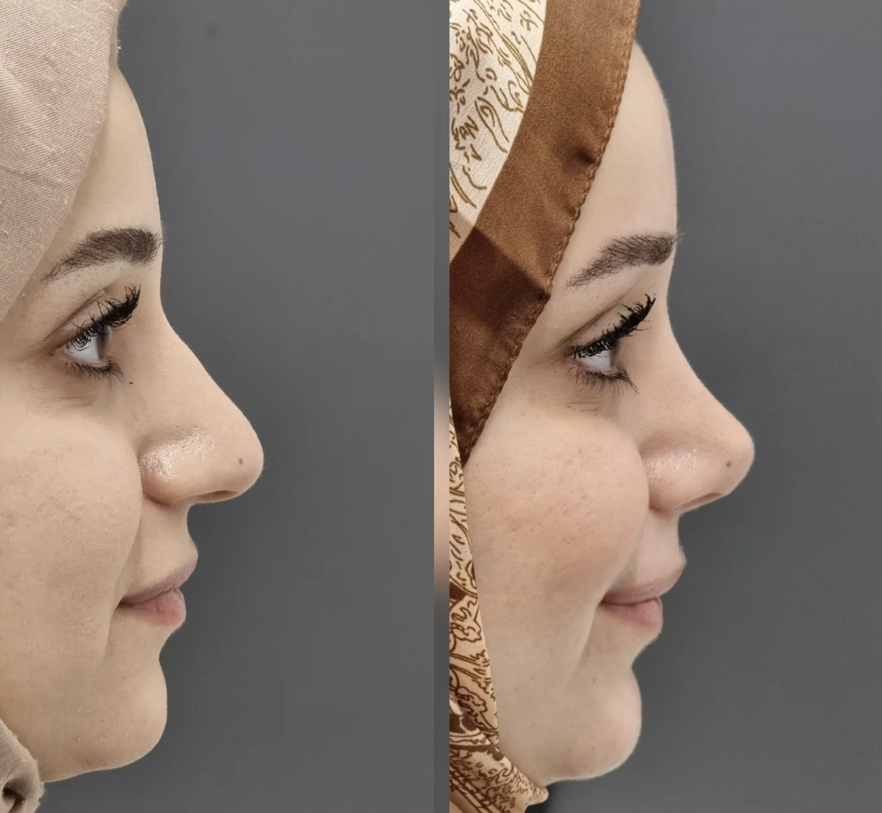 Operasyon Galerisi 2