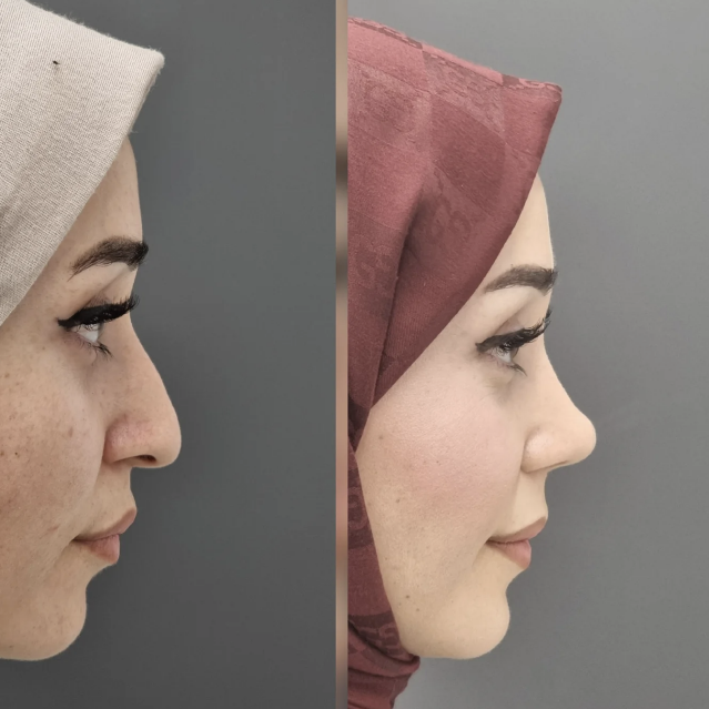 Operasyon Galerisi 1